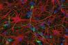 Murine neurons