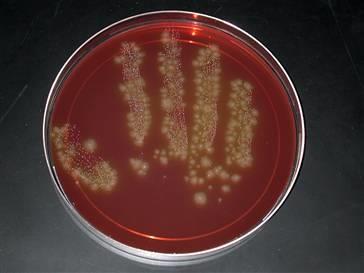c diff hand
