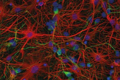 Murine neurons